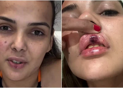 Engenheira acusa ex-namorado de agressão