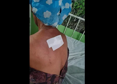 Idosa foi atingida com um golpe de faca nas costas