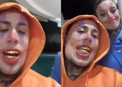 MC Daniel com prótese de ouro nos dentes
