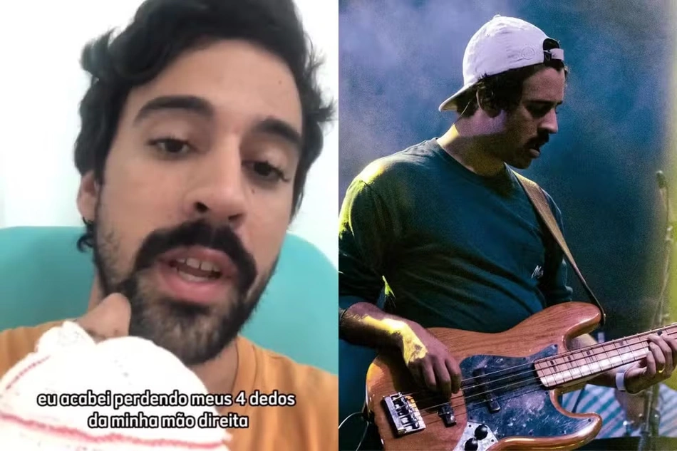 Guilherme Goes perdeu quatro dedos da mão direita