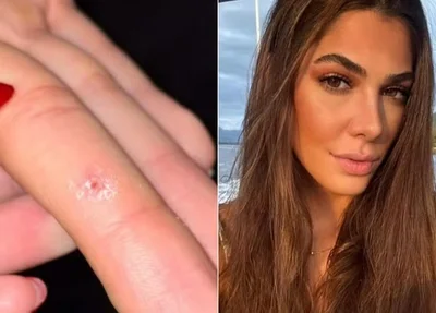 Victoria Pinese Sartorelli, de 24 anos, levantou polêmica nas redes sociais ao relatar que contraiu o vírus HPV na academia