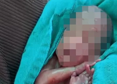 O bebê permanece internado em estado grave