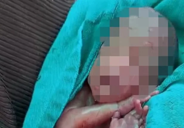 O bebê permanece internado em estado grave