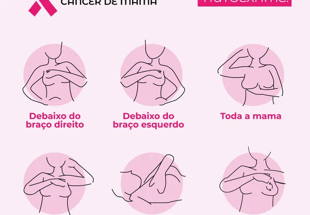 Rede Feminina de Combate ao Câncer reforça importância do diagnóstico precoce do câncer de mama