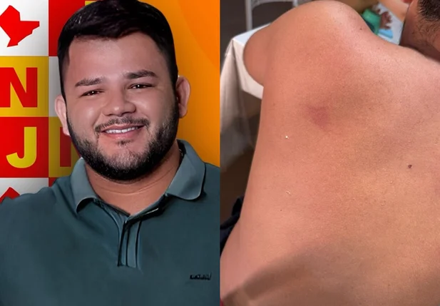 Vereador José Carlos Machado Pereira Júnior é acusado de agredir um homem em Parnaíba