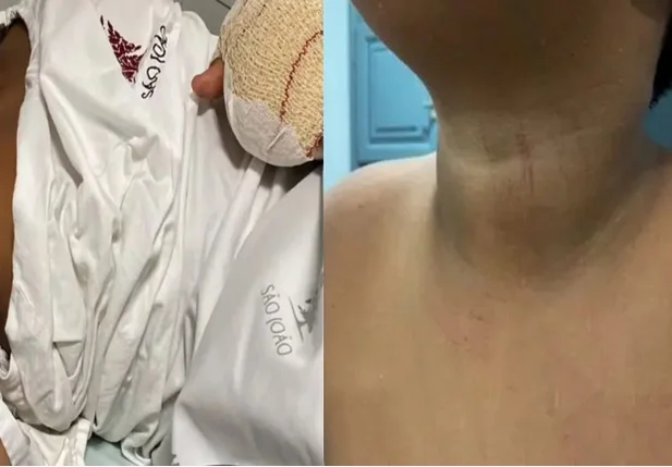 Criança brasileira é vítima de agressões em escola de Portugal