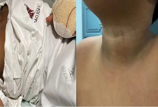 Criança brasileira é vítima de agressões em escola de Portugal