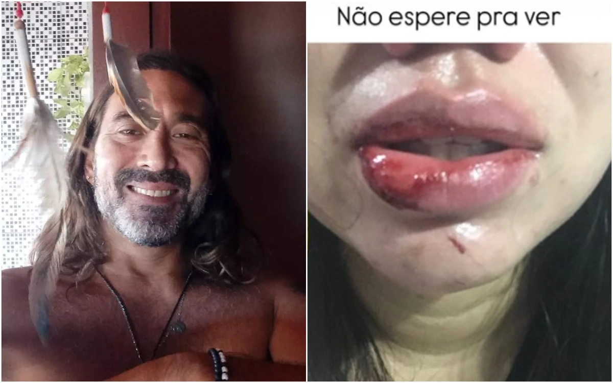 Renato Lee é acusado de agredir companheira em Teresina
