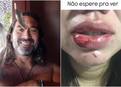 Renato Lee é acusado de agredir companheira em Teresina