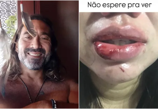 Renato Lee é acusado de agredir companheira em Teresina