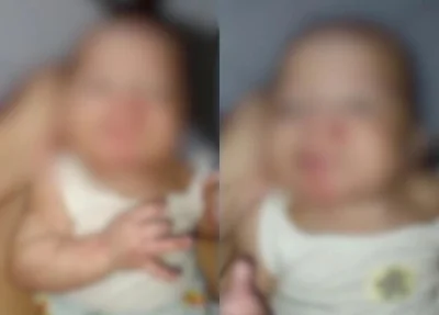 Bebê apresentava marcas pelo corpo
