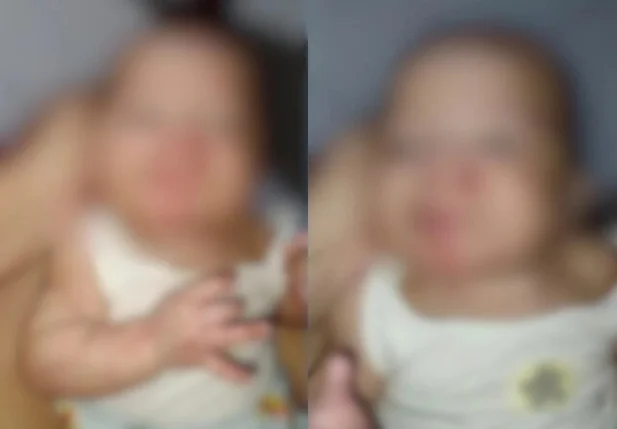 Bebê apresentava marcas pelo corpo