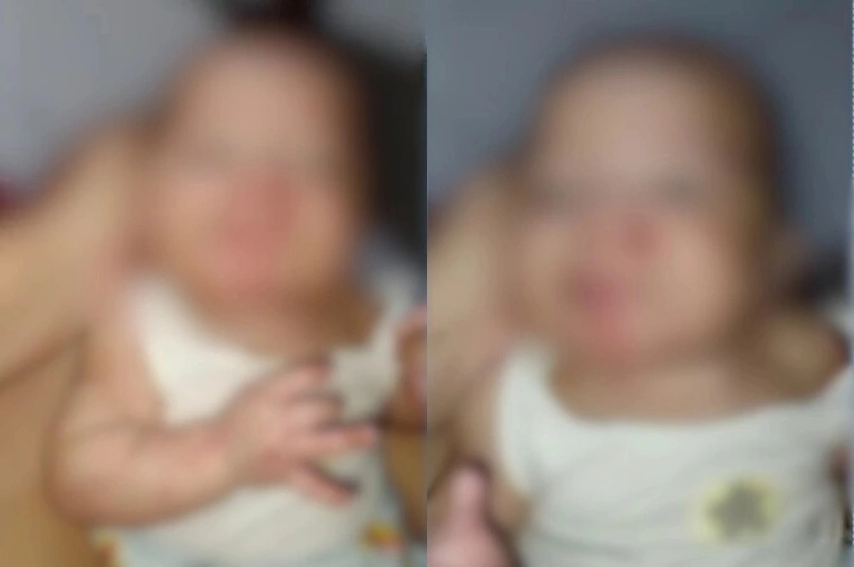 Bebê apresentava marcas pelo corpo