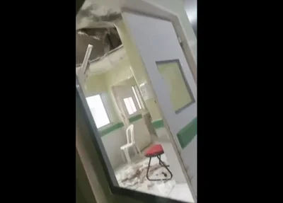 Parte do forro da UPA de Bom Jesus cai durante reforma