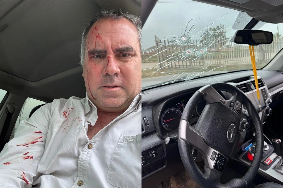 Pré-candidato é alvo de disparos no Peru