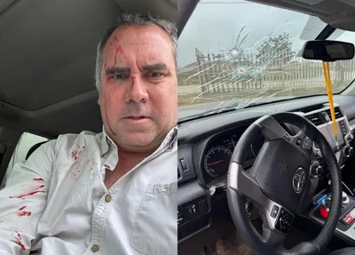 Pré-candidato é alvo de disparos no Peru