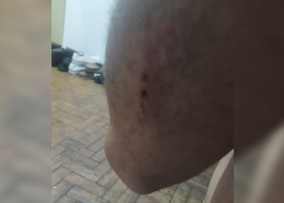 Exército expulsa militares acusados de torturar soldado dentro de quartel em São Paulo