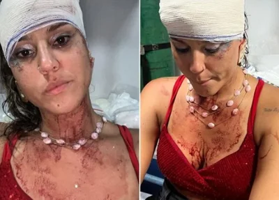 Mulher é agredida por polícias militares em Pernambuco