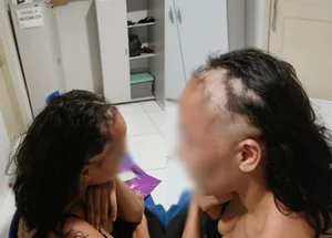 Mulher é investigada por raspar a cabeça e simular agressão para denunciar companheiro