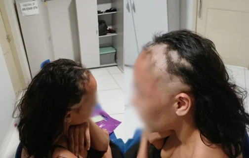 Mulher é investigada por raspar a cabeça e simular agressão para denunciar companheiro