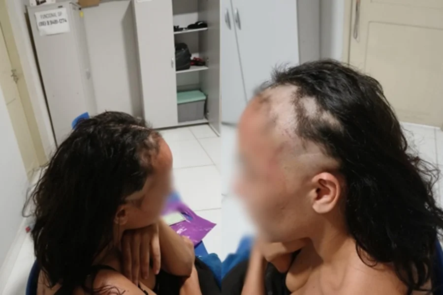 Mulher é investigada por raspar a cabeça e simular agressão para denunciar companheiro