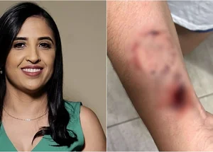 Prefeita Dra. Kaylanne foi acusada de ferir enfermeira com mordidas