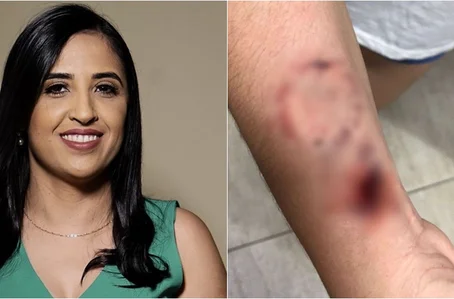 Prefeita Dra. Kaylanne foi acusada de ferir enfermeira com mordidas