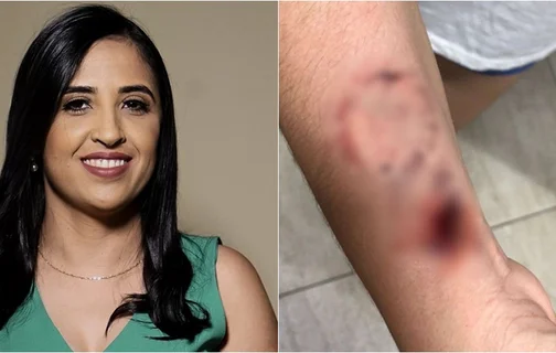 Prefeita Dra. Kaylanne foi acusada de ferir enfermeira com mordidas