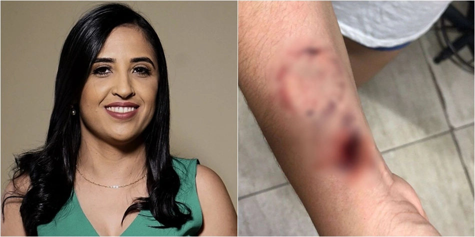 Prefeita Dra. Kaylanne foi acusada de ferir enfermeira com mordidas