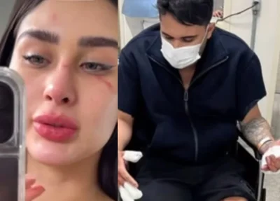 Miss Amazonas acusa ex-namorado de agressão