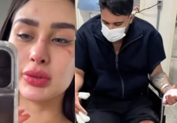 Miss Amazonas acusa ex-namorado de agressão