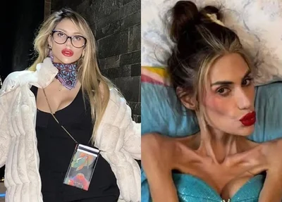 Antes e o depois da influencer Nihal Candan