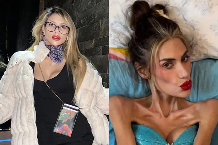 Antes e o depois da influencer Nihal Candan