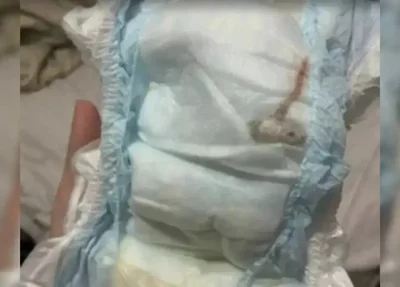 Mariana Sobral denunciou que encontrou um rato morto dentro da fralda