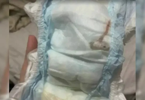 Mariana Sobral denunciou que encontrou um rato morto dentro da fralda