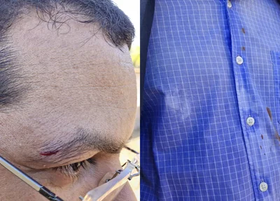 Denis Constantino foi agredido durante operação do DENARC
