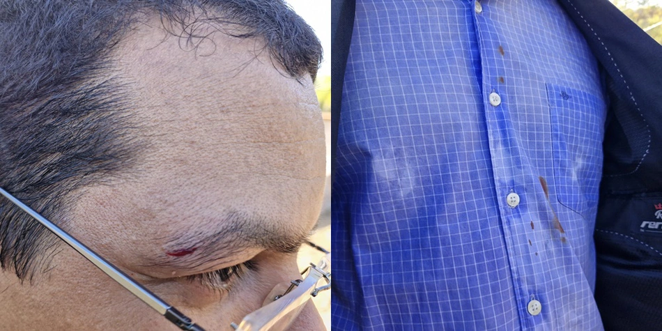 Denis Constantino foi agredido durante operação do DENARC