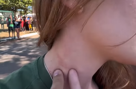 Jovem agredida na CONUNE