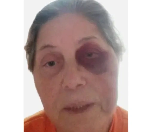 Jucilene Costa do Nascimento após agressão