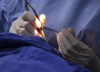 Médico realizando procedimento cirúrgico