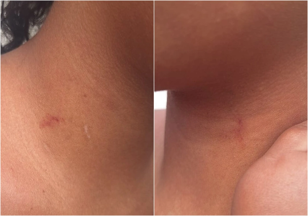 Adolescente de 13 anos apresentava marcas de agressão