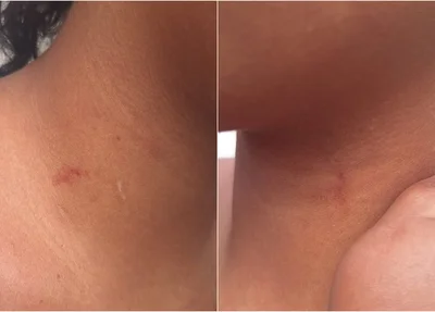 Adolescente de 13 anos apresentava marcas de agressão