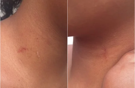 Adolescente de 13 anos apresentava marcas de agressão