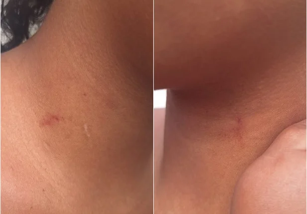 Adolescente de 13 anos apresentava marcas de agressão