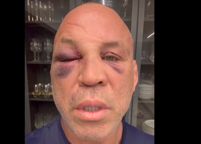 Wanderlei Silva após briga com Popó