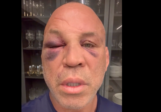 Wanderlei Silva após briga com Popó