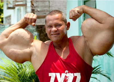 Arlindo Anomalia