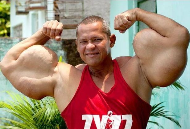 Arlindo Anomalia