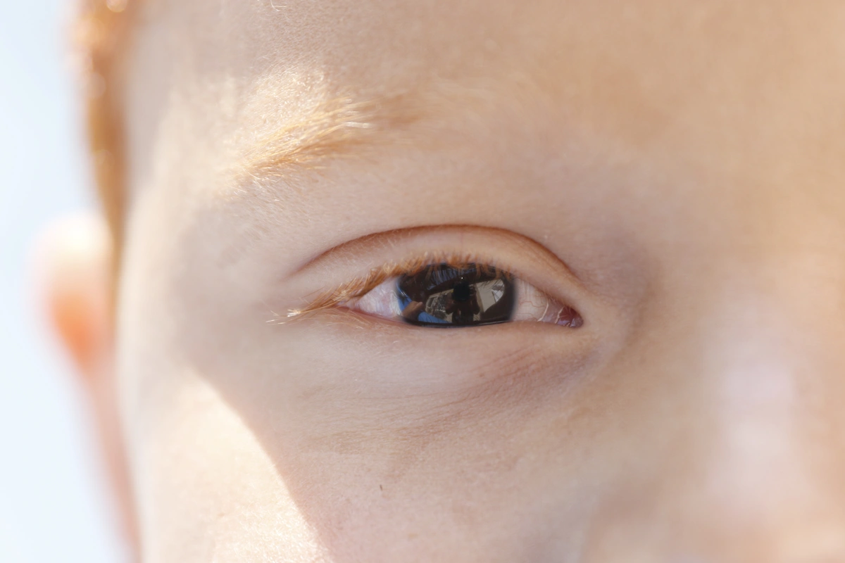 Pessoas com essa condição têm uma pequena área da retina gradualmente danificada