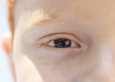 Pessoas com essa condição têm uma pequena área da retina gradualmente danificada